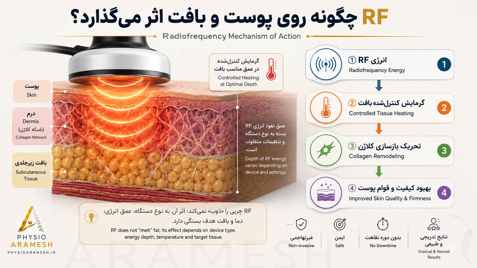 رادیوفرکانسی (RF) چیست و چگونه عمل می‌کند؟